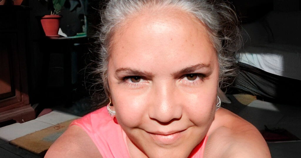 Musa dos anos 90 abre o jogo sobre aparência: “Não tem como ser igual” Tereza Seiblitz